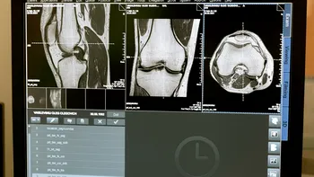 Aproape 45% dintre oameni nu au acest os în corp. Care este explicația oamenilor de știință