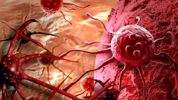 Cum poate fi detectat cancerul. Descoperirea fascinantă a cercetătorilor