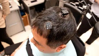 Implantul cerebral care transformă gândul în mișcare, speranța oamenilor paralizați: ce rol joacă inteligența artificială