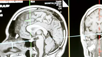Legătura nebănuită dintre craniile oamenilor și un pește. Un mister vechi de 455 de milioane de ani, rezolvat