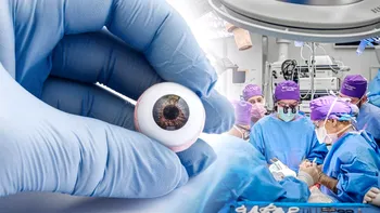 Primul transplant complet de ochi a avut loc, în Statele Unite ale Americii. Cine este pacientul şi câte ore a durat intervenţia