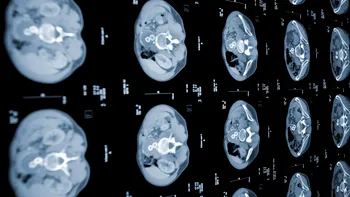Cum descoperi cancerul din timp, cu ajutorul inteligenței artificiale. Noile cercetări ale oamenilor de știință ne dau speranțe