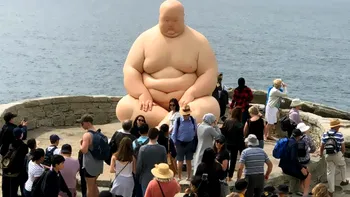Epidemie globală de obezitate: Peste 1 miliard de oameni sunt afectați în lume