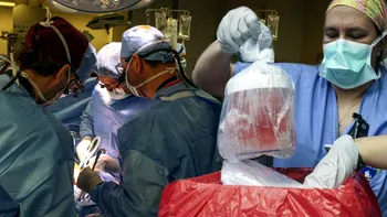Prima persoană din lume care a primit un transplant de rinichi de porc a decedat după intervenție