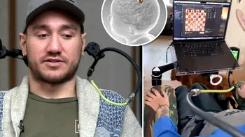 Acest pacient de la Neuralink spune că implantul i-a oferit abilități incredibile în gaming