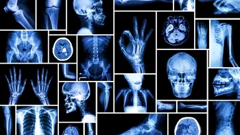 Aproape jumătate dintre oameni nu au acest os în corp: S-ar putea să fii surprins să afli că ești printre ei