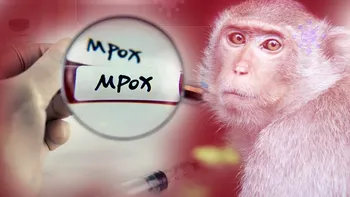 OMS declară mpox, cunoscută ca 