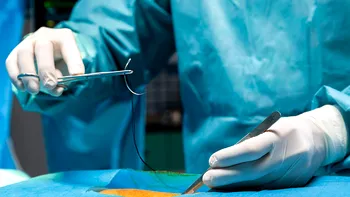 Cusăturile chirurgicale cu stimulare electrică, noua revoluție în medicină pentru vindecare mai rapidă
