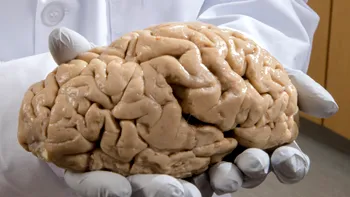 De ce au oamenii creierul atât de mare? Microbii intestinali ar putea fi răspunsul, conform cercetătorilor