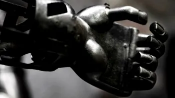 Chirurgia modernă a început cu o mână de fier și a continuat cu primele proteze tehnologice complexe