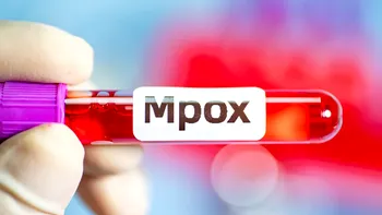 Alarmă sanitară: Noua variantă mpox se răspândește rapid și amenință să devină o criză globală