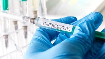 Vaccin revoluționar împotriva tuberculozei: tehnologia ARNm oferă rezultate promițătoare în teste
