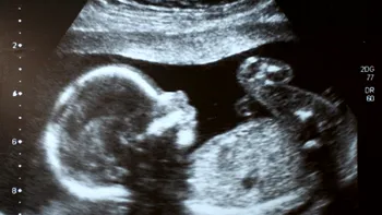Tratament revoluționar: o boală genetică rară a fost tratată pentru prima dată în uter