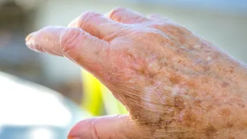 Îmbătrânirea pielii ar putea fi întoarsă din drum: Hormonii care te-ar putea întineri