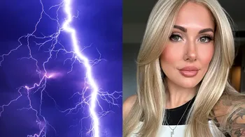 Lovită de un fulger, a fost paralizată ore întregi şi a rămas cu un ochi de culoare diferită. 