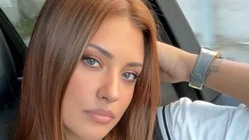 Coșmarul prin care a trecut Antonia în ultimele luni, în tăcere, după o procedură estetică. Artista a ajuns la trei operații: „Putea avea un final tragic”