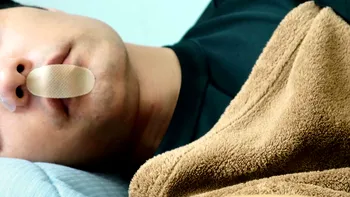 TikTok, un real pericol. Bandă pe gură în somn? Trendul „mouth taping” de pe rețeaua de socializare nu te poate vindeca, din contră