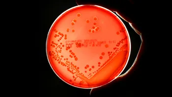 Superbacteriile amenință sănătatea globală și economia. Pericolul tăcut care ar putea provoca milioane de decese