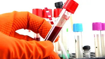 Un test de sânge revoluționar arată vârsta reală a organelor și promite să transforme medicina