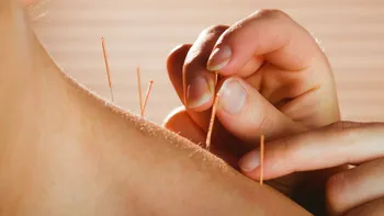 Acul din oțel care a scris istorie: cele mai vechi ace de acupunctură, descoperite într-un mormânt imperial din China