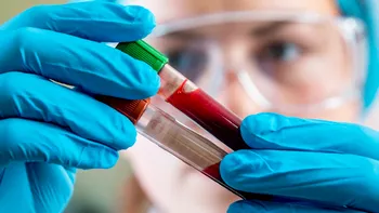 Un simplu test de sânge ar putea prezice scleroza laterală amiotrofică cu zece ani înainte de simptome