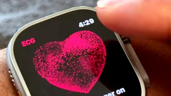 Cum funcționează detectarea hipertensiunii, afecțiunea secolului la nivel global, pe ceasurile inteligente Apple Watch Series 11 și Ultra 3