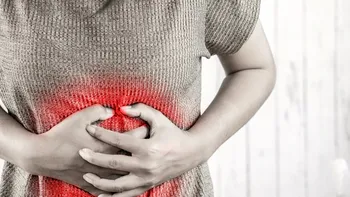 Ce este diverticuloza intestinală, legătura cu sănătatea colonului. Cum o previi, conform medicilor