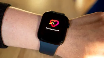 Ceasul Apple ar putea identifica hipertensiune arterială. Ce spun specialiștii despre acuratețea datelor