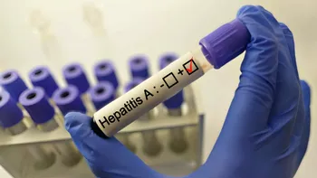 Focar de hepatită A în Dolj: peste 150 de cazuri depistate. Autoritățile iau măsuri după valul de cazuri