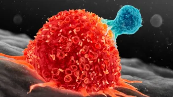 Celulele canceroase ar putea să dispară cu ajutorul luminii. Cum au reușit oamenii de știință să facă marea descoperire