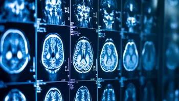 Tehnologia imersivă care îi ajută pe neurochirurgi să salveze vieți. Cum schimbă realitatea mixtă pregătirea pentru operații