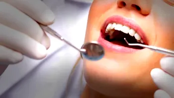 Se schimbă plombele dentare la nivel global pentru binele nostru