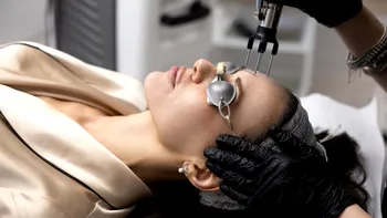 Tehnologie de vârf în îngrijirea pielii: ce oferă intervențiile cu laser CO₂ pentru tenul tău