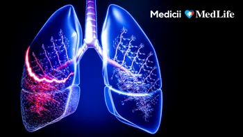 Mesajul Dr. Andrei Dobrea, chirurg toracic, care schimbă lupta cu cancerul pulmonar: „Oricât de rău pare, există soluții”