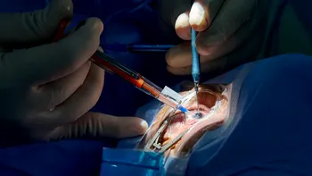 Premieră medicală: un chirurg a folosit Apple Vision Pro într-o operație de cataractă și schimbă modul în care medicii colaborează