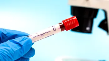 Lista actualizată a țărilor afectate de hantavirus în 2026. Unde circulă cele mai periculoase tulpini și ce risc de infectare există