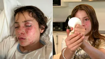 Provocare TikTok periculoasă pentru adolescenți. Viața unei tinere, la limită