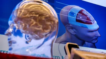 China provoacă Neuralink cu o tehnologie fără operații pe creier. Pariul care poate schimba viitorul implanturilor cerebrale