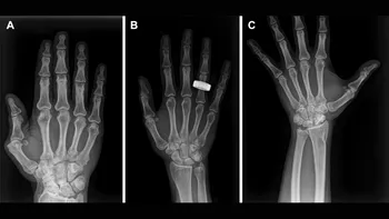 Premieră medicală în spațiu: astronauții au realizat primele radiografii direct pe orbită