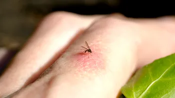 Cum scapi de viespi și țânțari din curte fără insecticide puternice. Soluțiile recomandate de specialiști