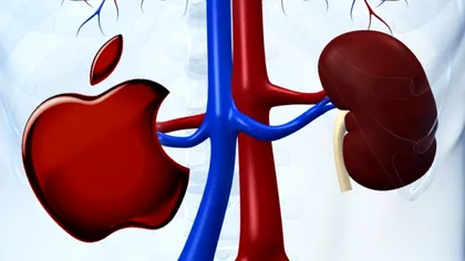 Ti-ai da un rinichi pentru un gadget? Cineva a facut-o...