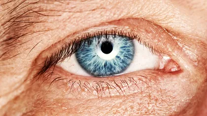 Medicamentul revoluționar care te scapă de cataractă