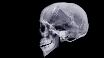 Cum îți afectează creierul băuturile energizante