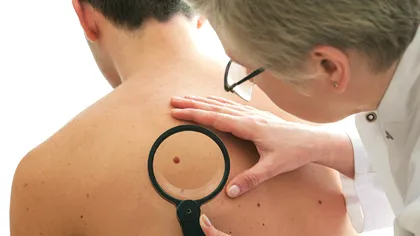 Aplicația care vrea să depisteze cancerul prin selfie-uri