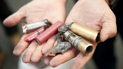 O țigară electronică i-a spulberat dinții după explozie