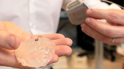 Un implant wireless în creier le-ar putea permite paraliticilor să meargă din nou