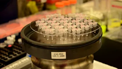 Un nou test de sânge ar putea detecta proteinele infecțioase
