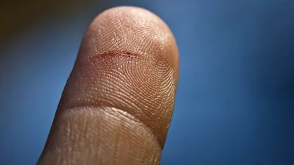 De ce ne dor atât de tare tăieturile provocate de hârtie [VIDEO]