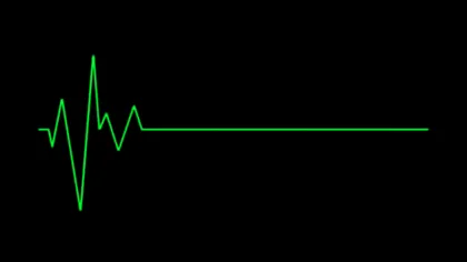 Activitatea cerebrală poate continua și după moarte