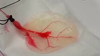 O frunză de spanac a fost transformată în țesut cardiac funcțional [VIDEO]